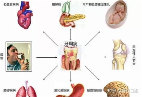 健康關係